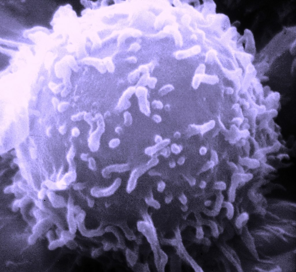 A lymphocyte, up close and personal (public domain image)