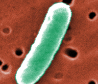 2008 Janice Haney Carr At an extremely high magnification of 44, 818X, twice that of PHIL 10574 and 10575, this colorized scanning electron micrograph (SEM) revealed some of the morphologic details displayed by a single Gram-negative Escherichia coli bacterium. This bacterium was a member of the strain, 0:169 H41 ETEC (Enterotoxigenic E. coli). See PHIL 10576 for a black and white version of this image.Enterotoxigenic E. coli, a common cause of bacterial diarrhea…Enterotoxigenic Escherichia coli, or ETEC, is an important cause of bacterial diarrheal illness. Infection with ETEC is the leading cause of travelers' diarrhea and a major cause of diarrheal disease in underdeveloped nations, especially among children. ETEC is transmitted by food or water contaminated with animal or human feces. Although ETEC causes a significant amount of illness worldwide, the infection will end on its own and is rarely life-threatening. What is ETEC?Escherichia colii is a bacterium that normally lives in the intestines of humans and other animals. Most types of E. coli are harmless, but some can cause disease. Disease-causing E. coli are grouped according to the different ways by which they cause illness. Enterotoxigenic Escherichia coli, or ETEC, is the name given to a group of E. coli that produce special toxins which stimulate the lining of the intestines causing them to secrete excessive fluid, thus producing diarrhea. The toxins and the diseases that ETEC causes are not related to E. coli O157:H7